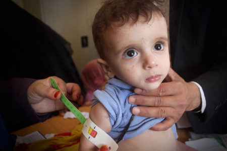 Niño yemení en una revisión médica