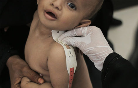 Niño en Yemen